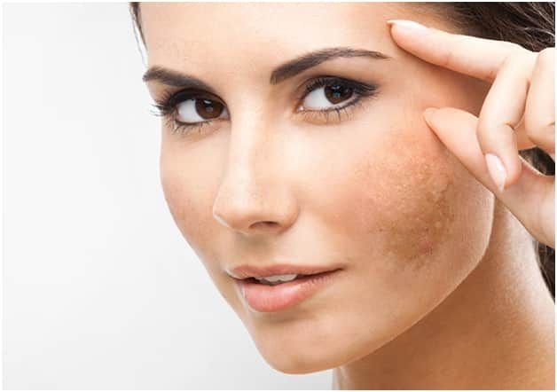 ADVANCED HYPERPIGMENTATION TREATMENT SOLUTIONS