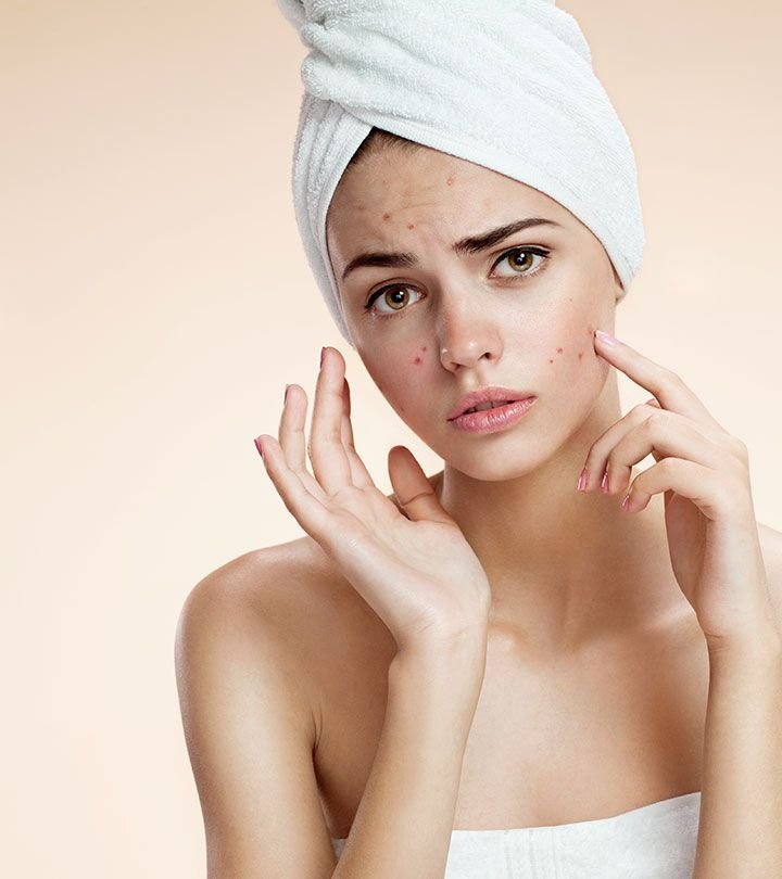 ACNE AND ACNE SCARS TREATMENT